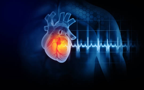 What is Congestive Heart Failure?